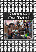 Kneecap On Trail